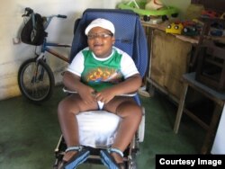 Diorkeblin Hernández Durruti padece el extraño síndrome de Momo.